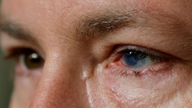 درمان آسیب‌های چشمی با سلول‌های بنیادی چشم یک شخص دیگر