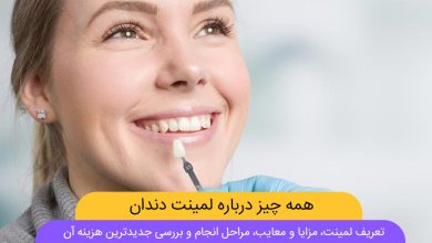 لمینت دندان؛ بهترین روش برای اصلاح طرح لبخند