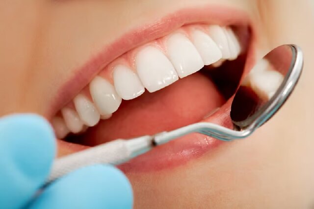 کدام موادغذایی از پوسیدگی دندان‌ها پیشگیری می‌کنند؟