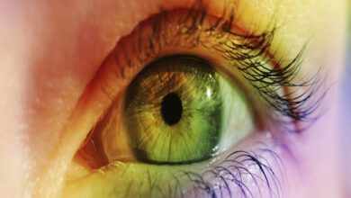 تغییر رنگ چشم؛ از عملی درمانی تا خطر کوری