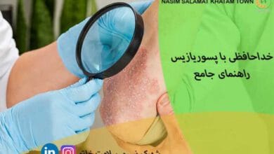 خداحافظی با پسوریازیس؛ راهنمای جامع