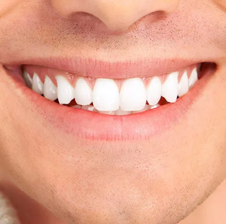 دهان؛ آیینهای از وضعیت سلامت بدن