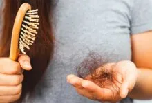 راهکارهایی برای پیشگیری از ریزش مو در فصل گرما