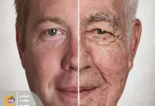 3 مشکل رایج برای پوست و راهکار پیشگیری از آن