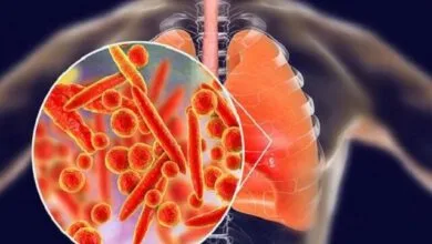 پنومونی؛ همچنان بزرگ‌ترین قاتل عفونی جهان