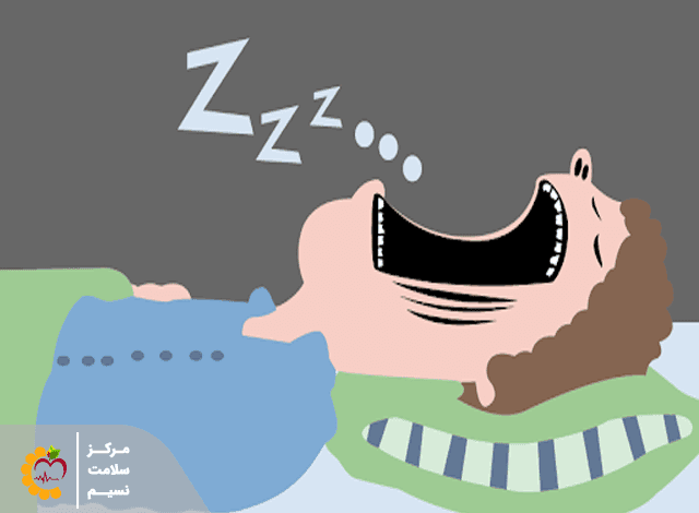 آپنه خواب چیست تشخیص و 5 راهکار درمان
