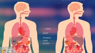 معکوس بودن اندام‌ها – ویروس کووید