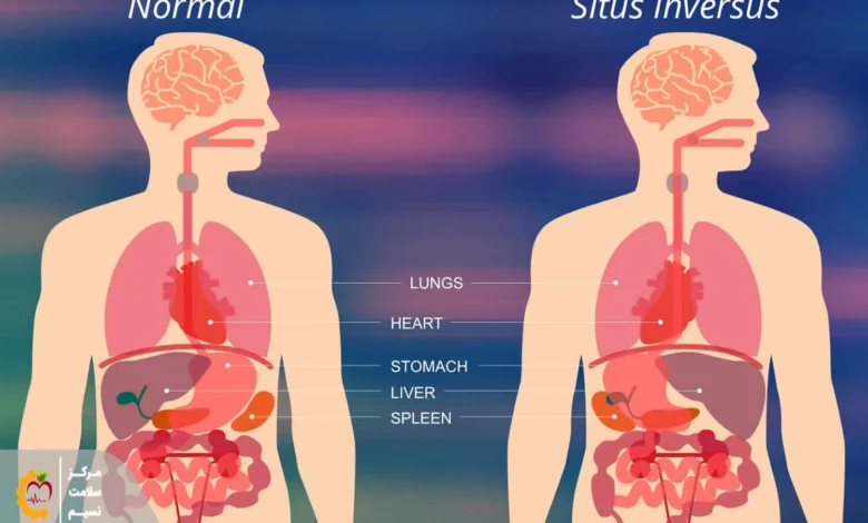 معکوس بودن اندام‌ها – ویروس کووید