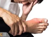 درمان فوری نقرس و خوراکی‌های مفید برای نقرس