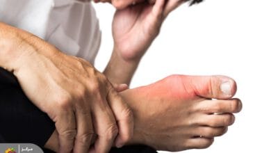 درمان فوری نقرس و خوراکی‌های مفید برای نقرس