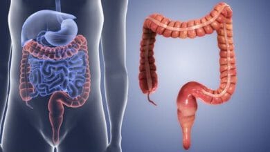 افزایش انسداد گوارشی ناشی از مصرف بی‌رویه «انار» و «خرمالو» در کودکان