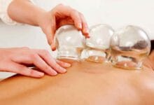 هشدار وزارت بهداشت درباره انجام خودسرانه حجامت